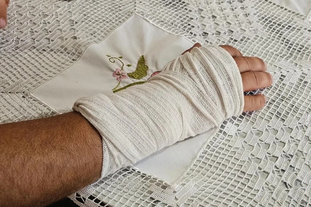 Başıboş köpek dehşeti durmuyor! Bacağı 2 yerden kırıldı 