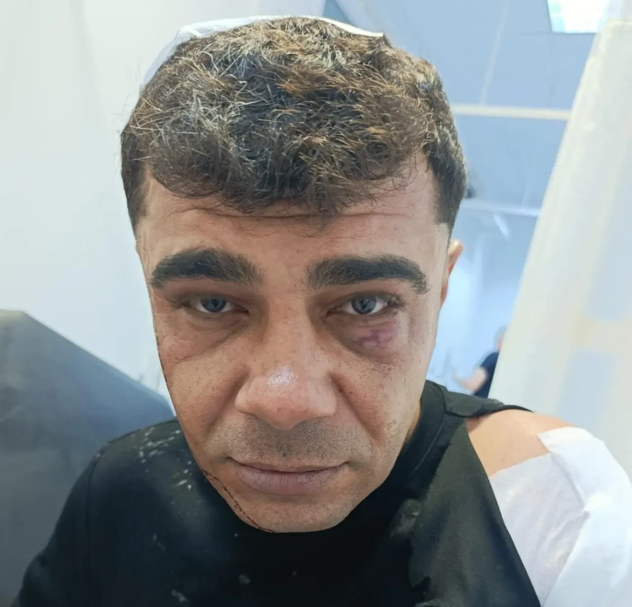 İş görüşmesine giderken dehşeti yaşadı! Ölümden döndü 