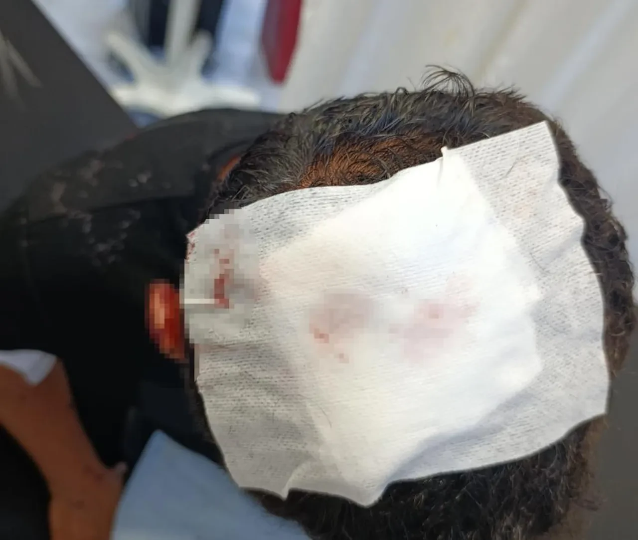 İş görüşmesine giderken dehşeti yaşadı! Ölümden döndü 