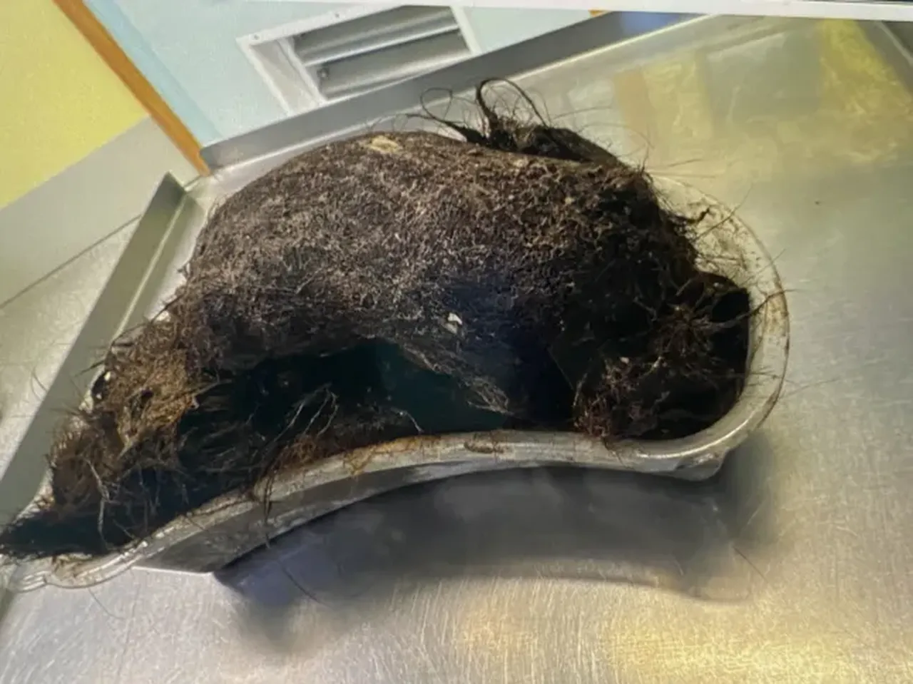 Henüz 14 yaşındaki çocuğun midesinden çıkan şoke etti! Erken müdahale uyarısı