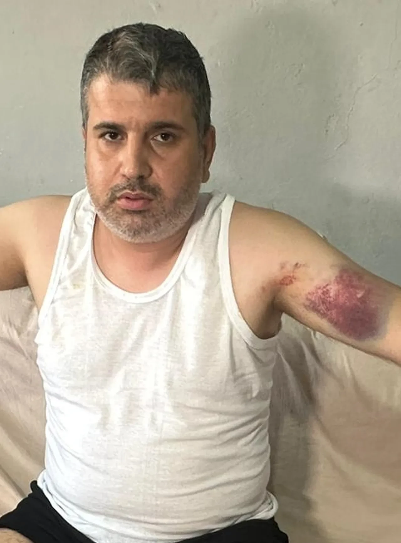 Beyzbol sopasıyla ölümüne dayak! Amca dehşeti kamerada! 