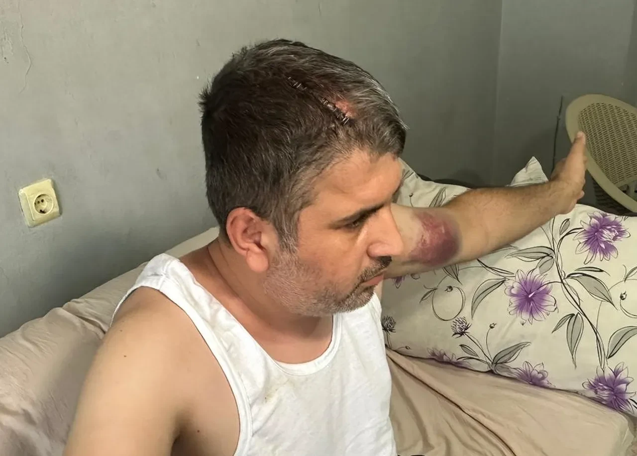 Beyzbol sopasıyla ölümüne dayak! Amca dehşeti kamerada! 