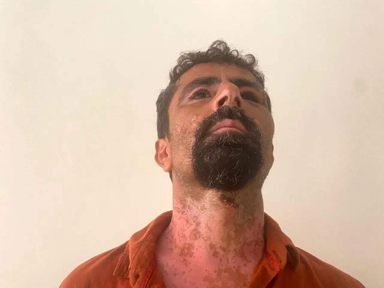 Damat dehşeti! Evi basıp, kayınpederini hastanelik etti