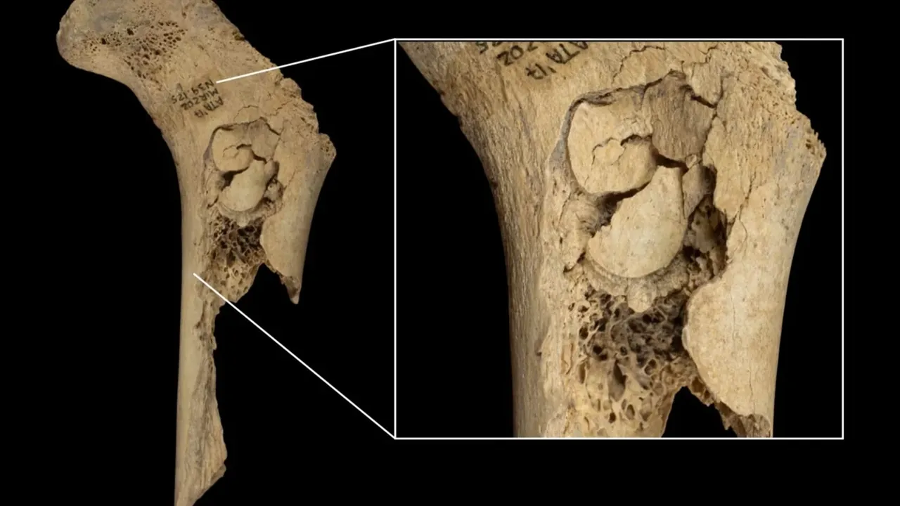 Pişirilmiş insan kalıntıları bulundu! Şoke eden keşif