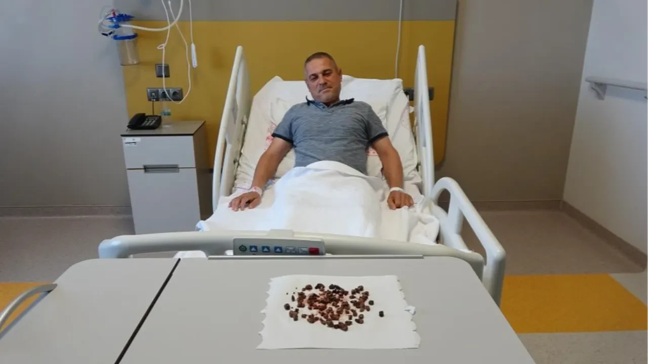 Doktorlar bile şaşkına döndü! Vücudundan tam 100 tane taş çıktı