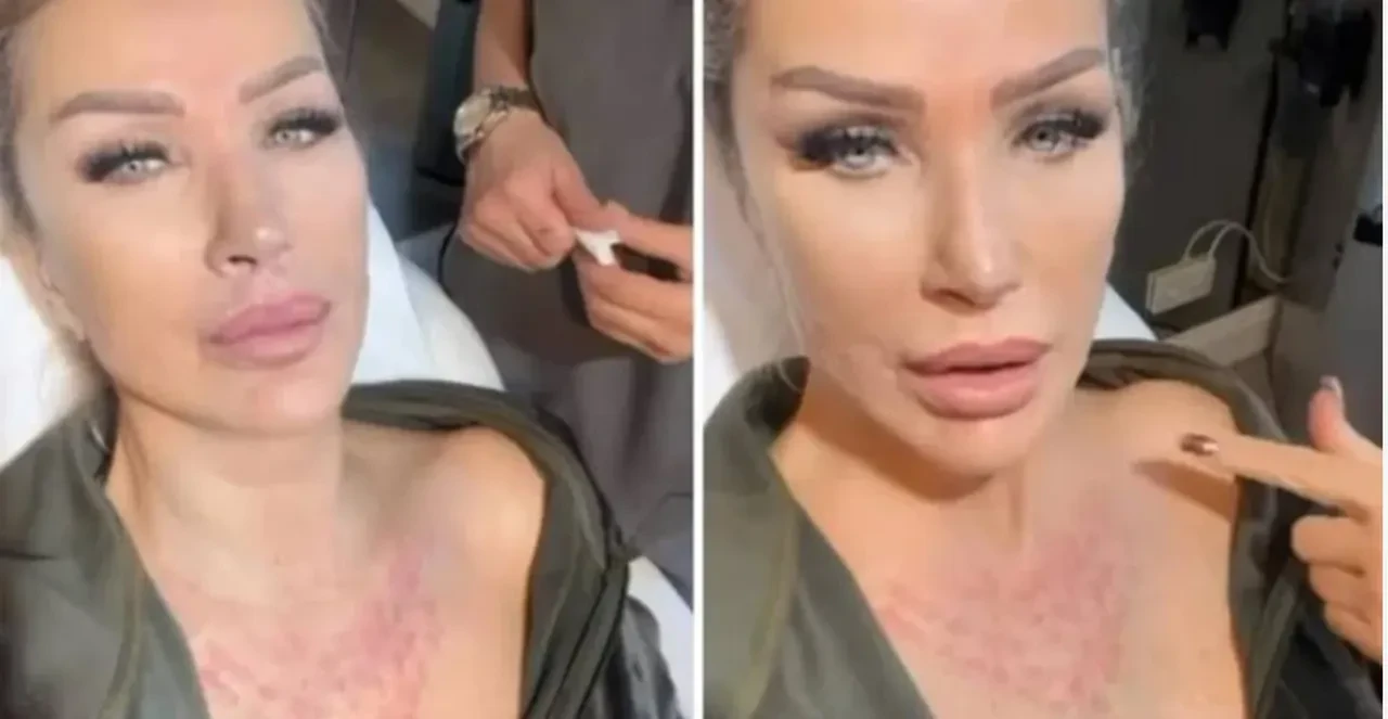 Seda Sayan estetik bağımlısı iddialarına cevap verdi! İlk kez bu kadar sert çıktı