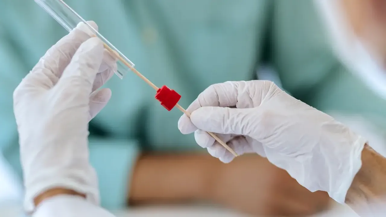 Kanserle mücadelede yeni dönem! Bakanlık harekete geçti! SMS ile bilgilendirilecek 