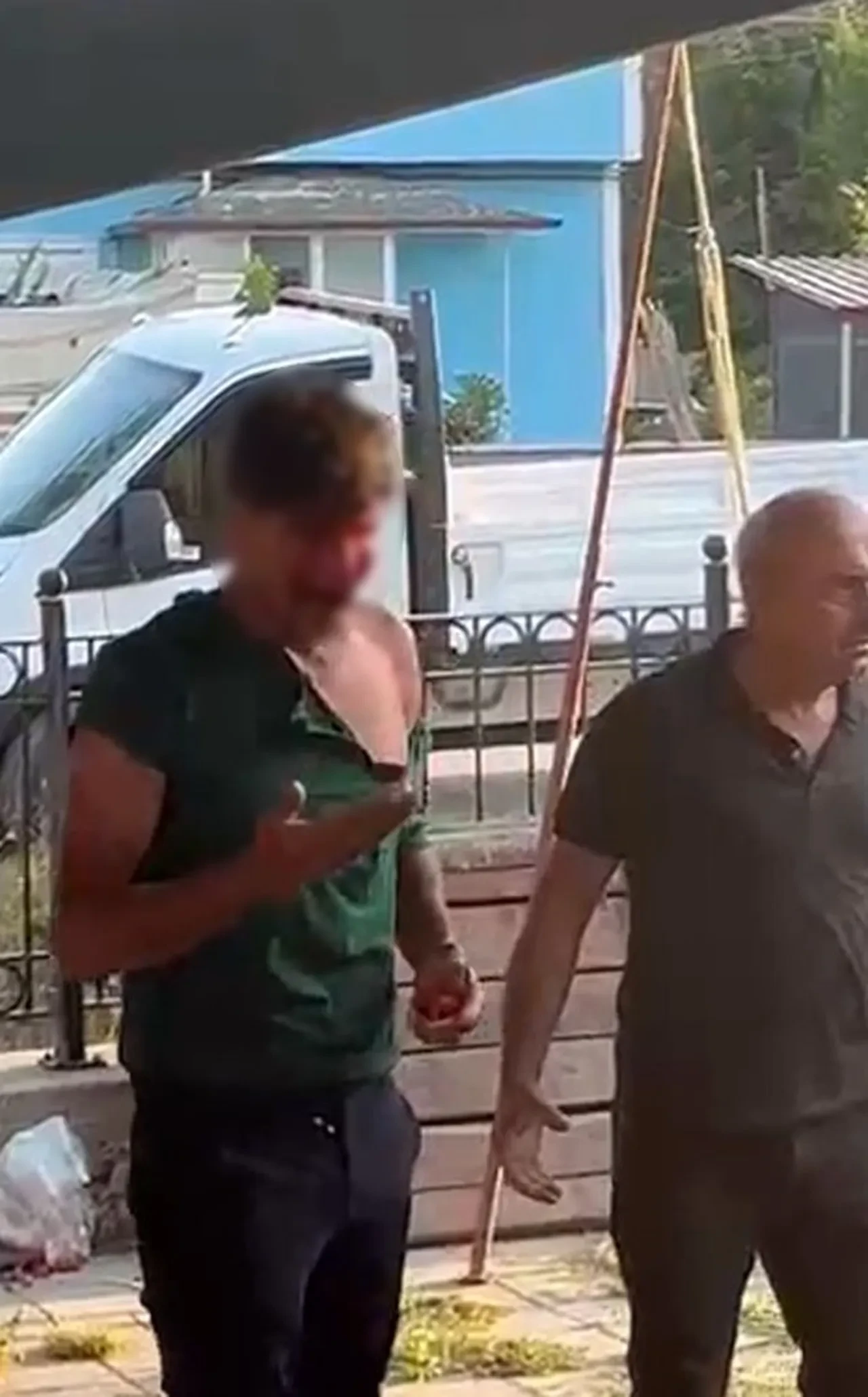 Pazar yerinde dehşet! Aralarına aldıkları genci öldüresiye dövdüler: Yüzü kanlar içinde kaldı