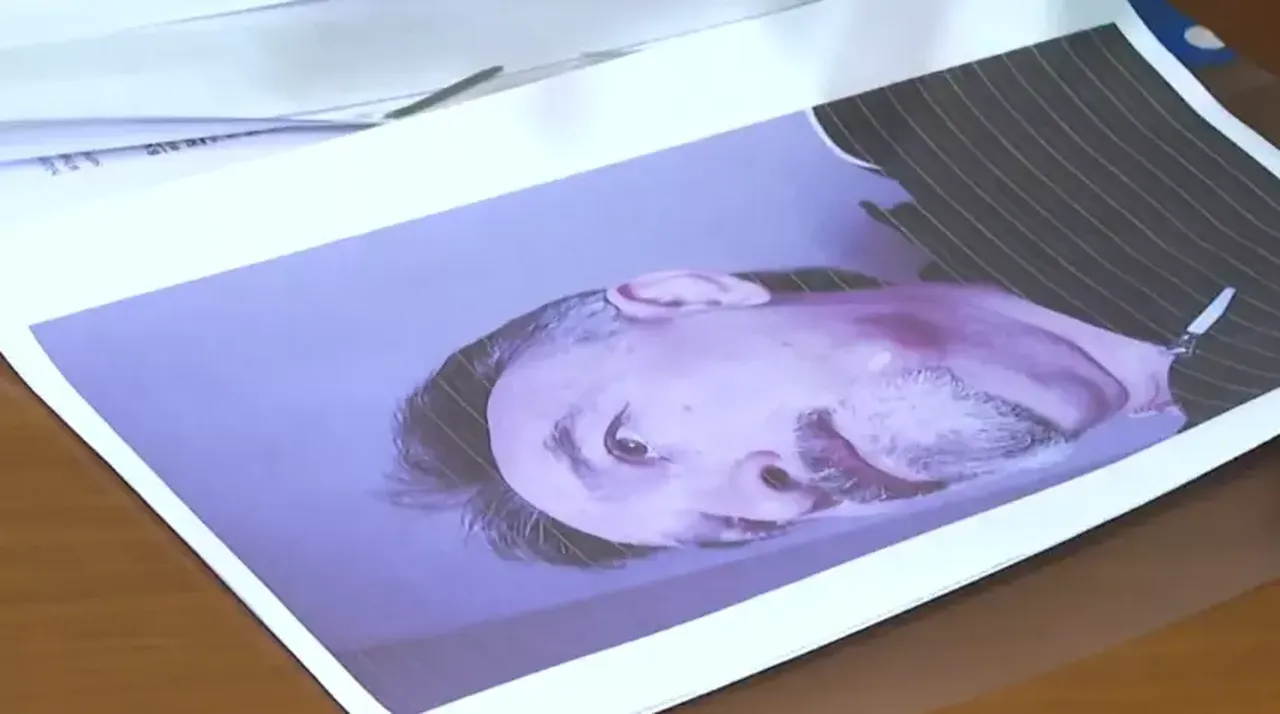 Diş tedavisi için Hollanda'dan geldi, canından oluyordu! Sahte doktor skandalı