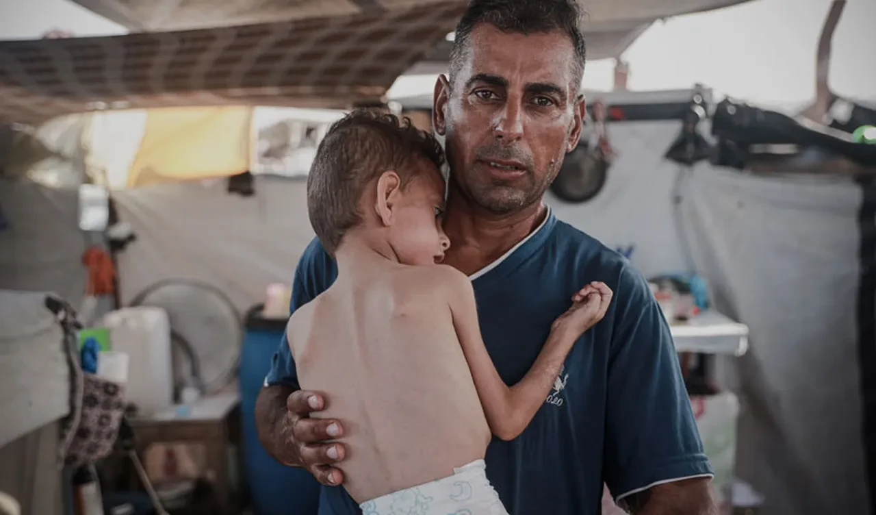 Birleşmiş Milletler Orta Doğu’da ilk kez Gazze’de kıtlık ilan etti