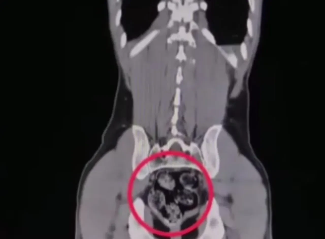 İranlı kuryenin uyuşturucuyu sakladığı yer şoke etti! Türkiye'ye zehir sokarken böyle yakalandılar 