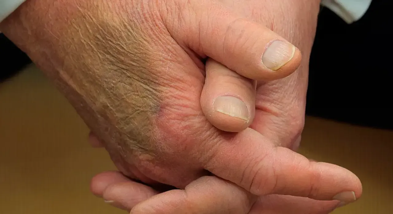 Donald Trump için Beyaz Saray ve doktorundan açıklama! Morluk günlerdir merak ediliyordu