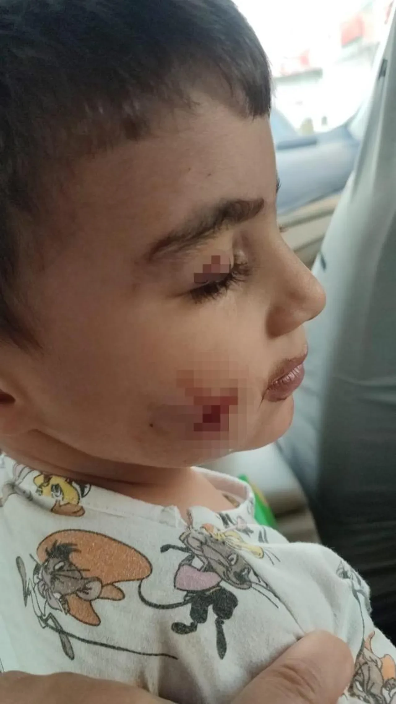 Küçük çocuk uykuda dehşeti yaşadı! Uyandığında yüzü diş izleri ve kanla kaplıydı