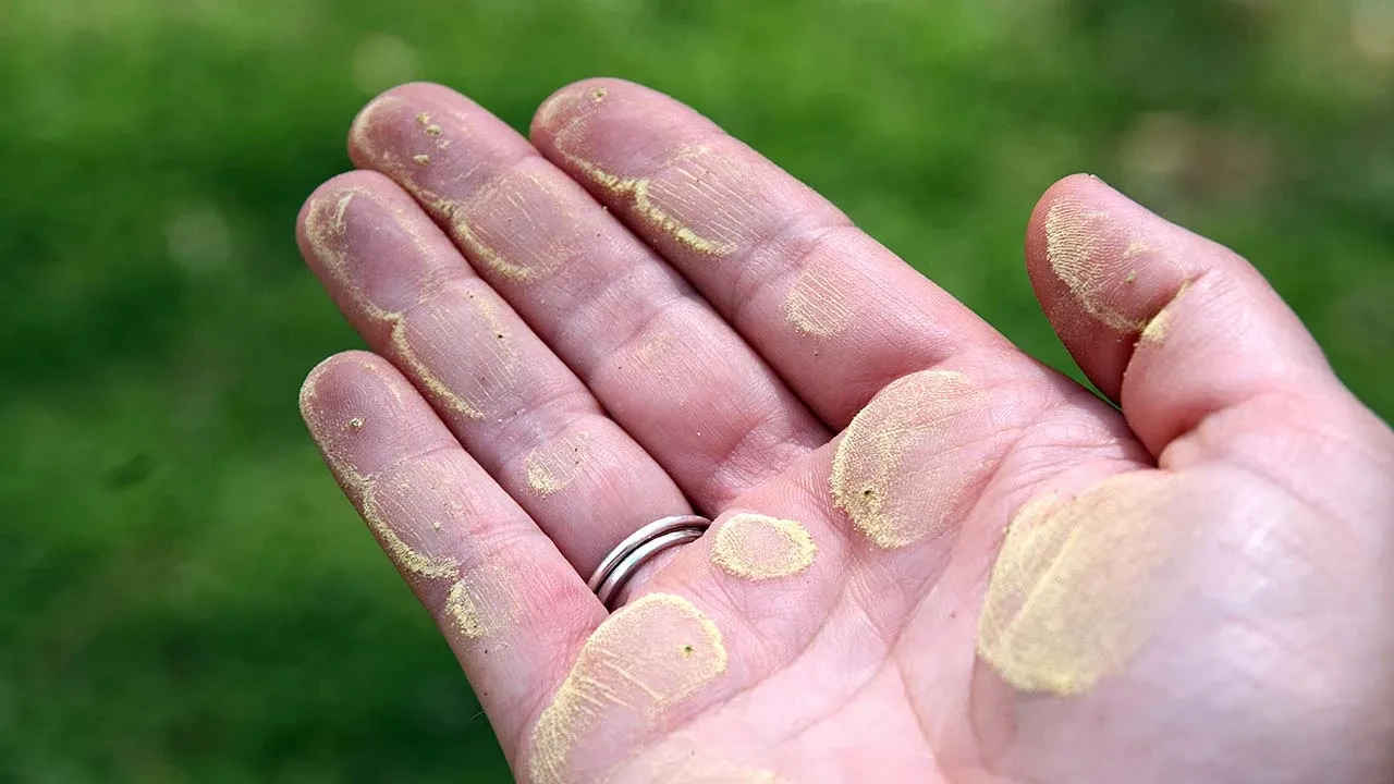 Türkiye için alarm verildi! 250 kat artacak: Cuma ve cumartesi günlerine dikkat 