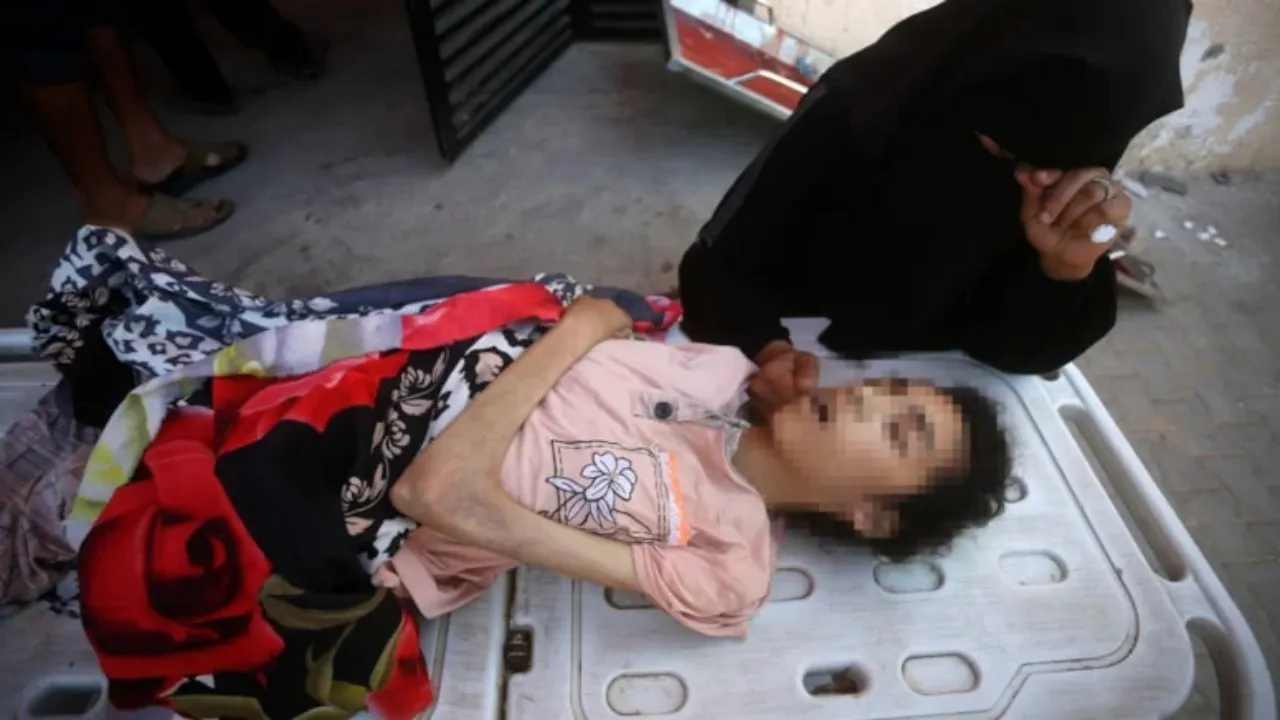 İsrail’in kıtlığa neden olduğu Gazze’de bir çocuk daha açlıktan hayatını kaybetti