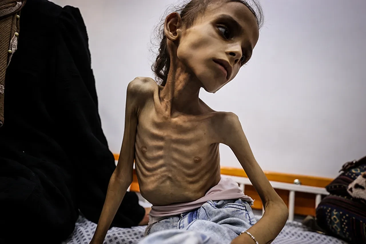 Gazzeli annenin feryadı insanlığı utandırır mı: Kızım yavaş yavaş ölüyor