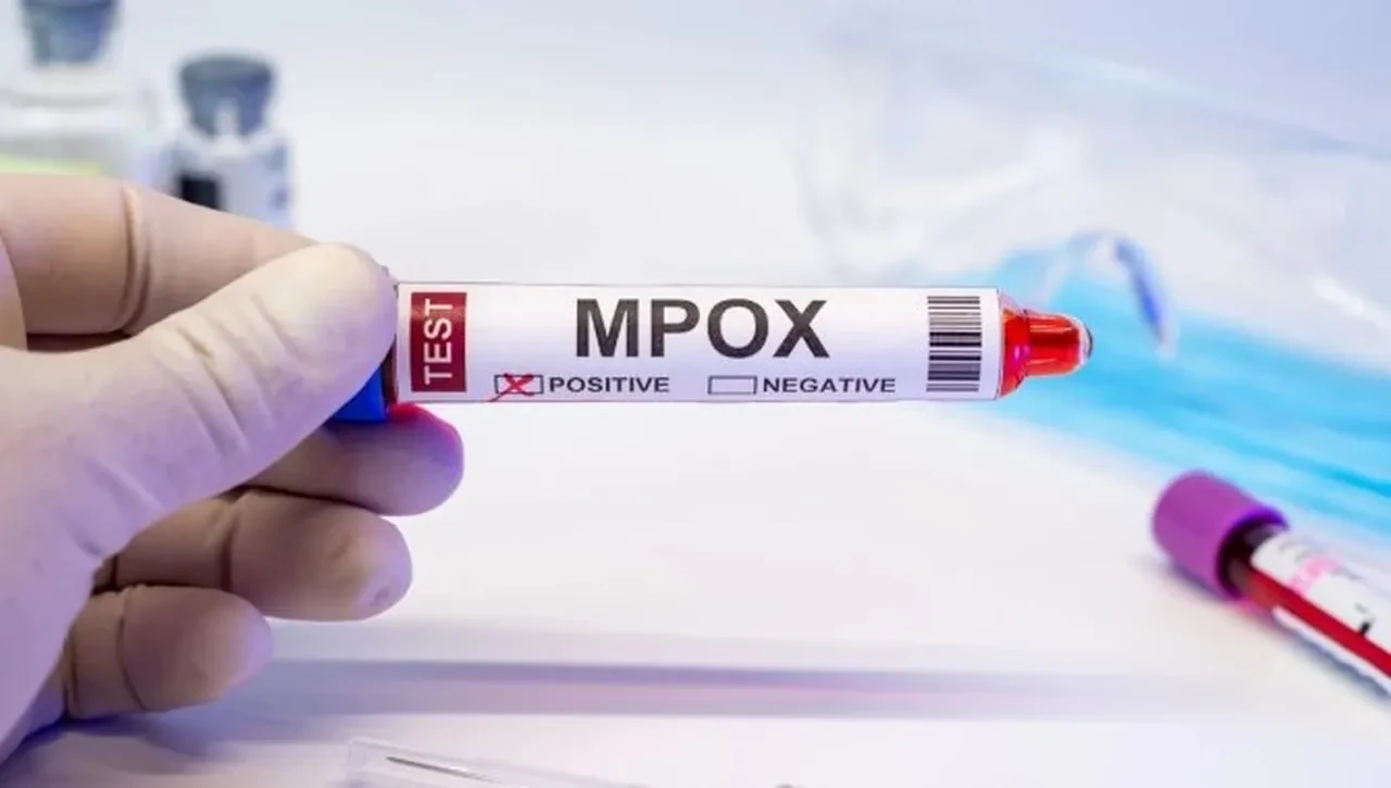 M (mpox) çiçeği virüsü yayılıyor, vakalar artmaya başladı