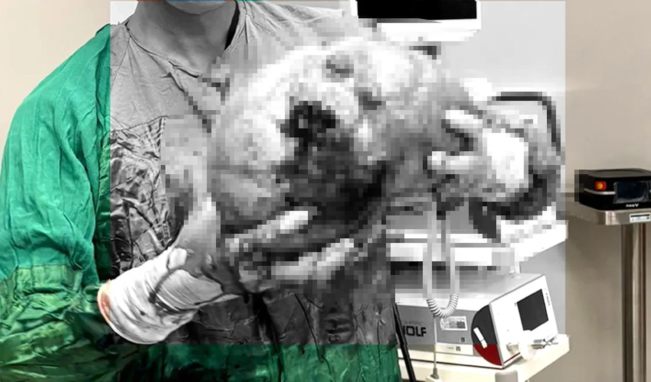 Karın ağrısı şikayetiyle hastaneye gitti! Karpuz büyüklüğündeki kitle şaşkına çevirdi