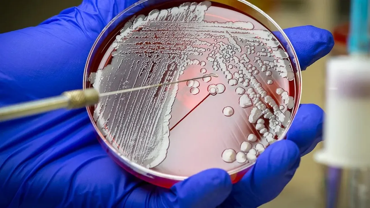 Dünyayı tedirgin eden yeni salgın Türkiye'de görüldü mü? Bakanlık'tan et yiyen bakteri açıklaması