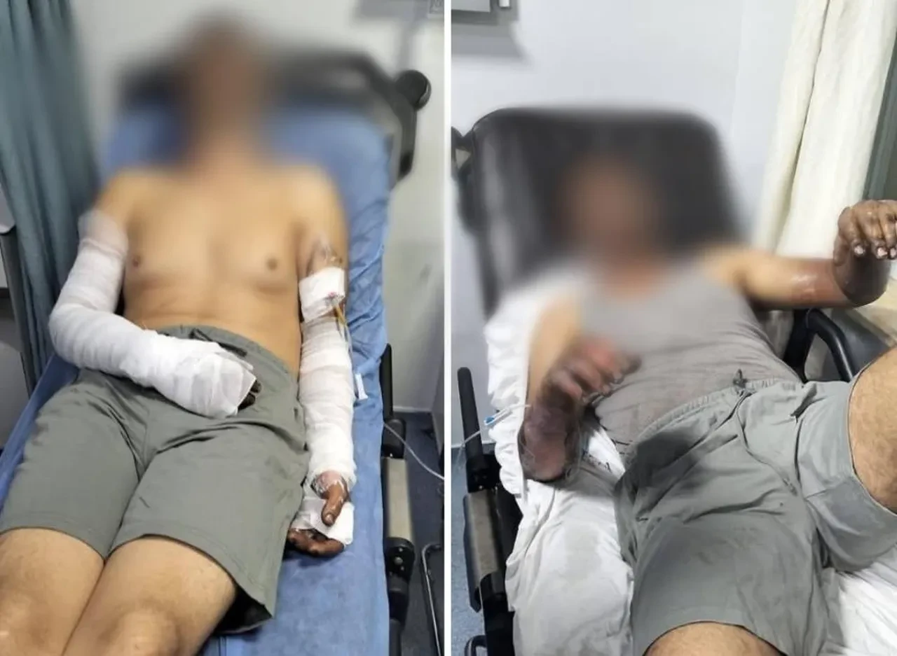 Manisa'da iş yerinde patlama! Ölümden döndüler