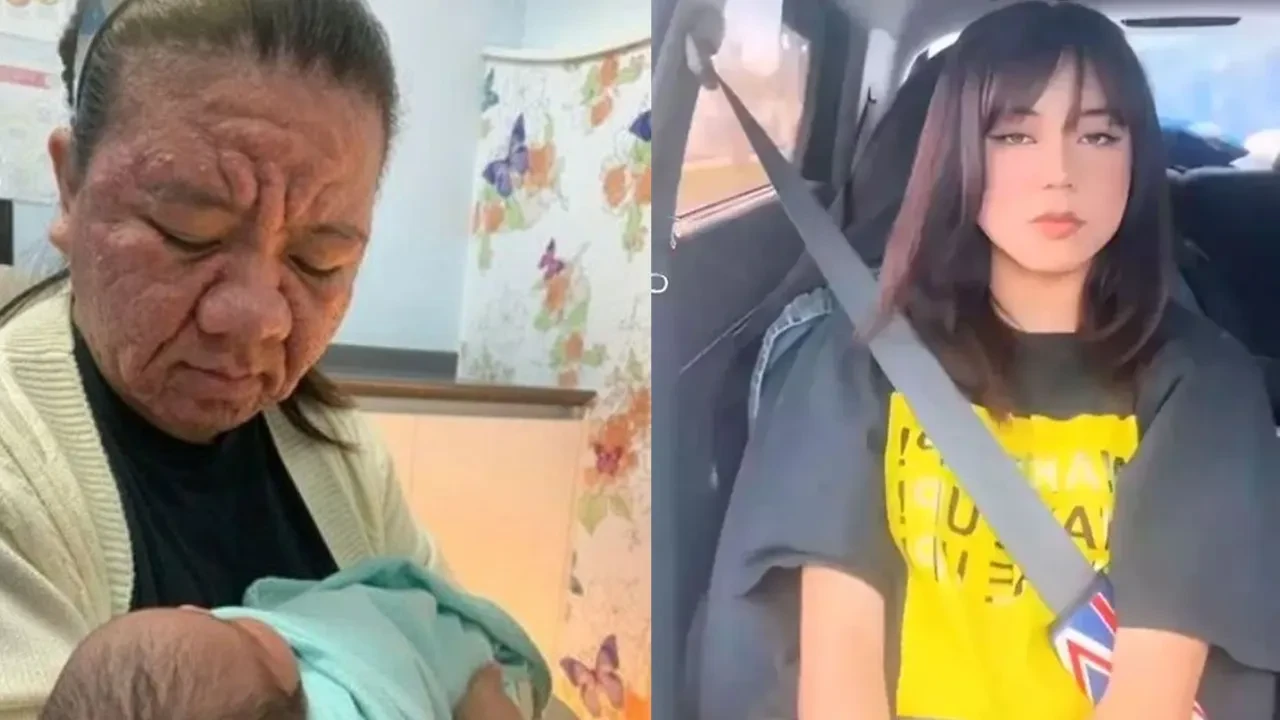 Hamileliğinde bir anda yaşlandı: 28 yaşındaki kadını görenler şoke oldu