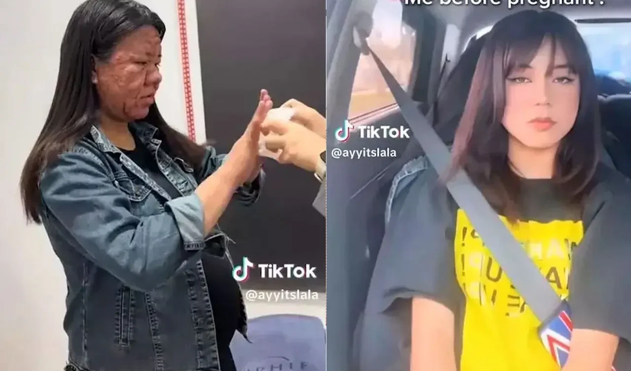 Hamileliğinde bir anda yaşlandı: 28 yaşındaki kadını görenler şoke oldu