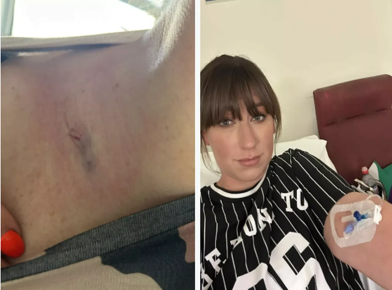 Sinsi hastalığını emniyet kemeri sayesinde fark etti