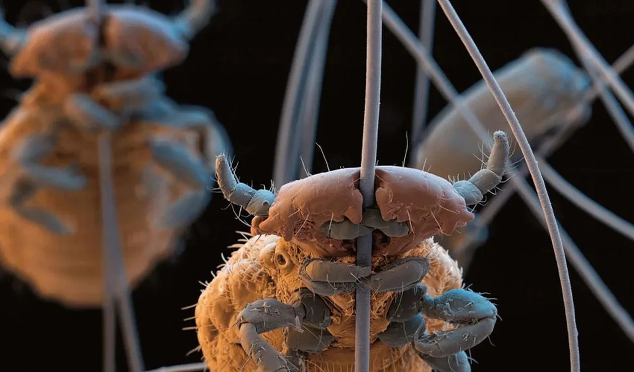 Şehirde artan gizemli parazit! Bilim insanları sahaya indi