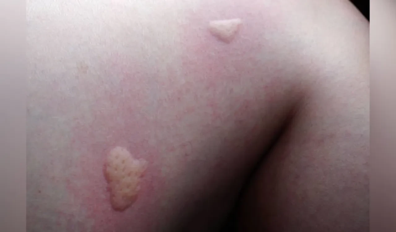 Şehirde artan gizemli parazit! Bilim insanları sahaya indi