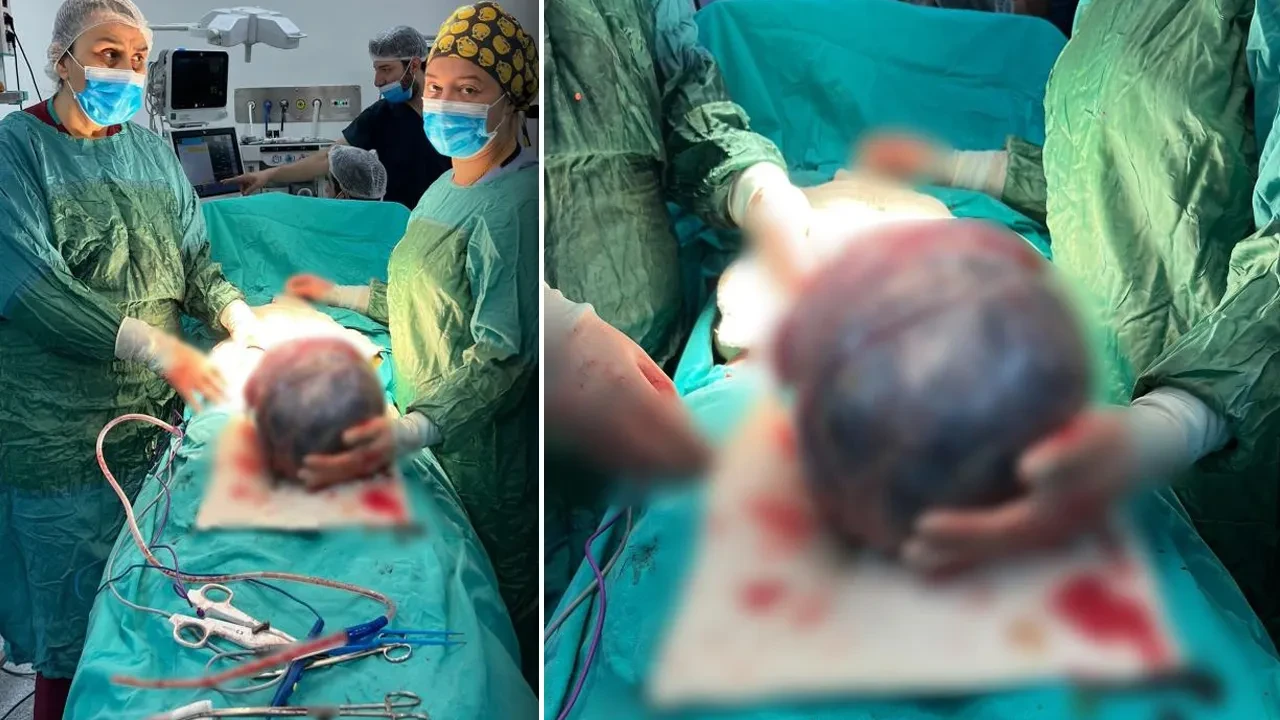 Hastanın karnından çıkan dev kitle şoke etti! Karnını tamamen doldurmuş