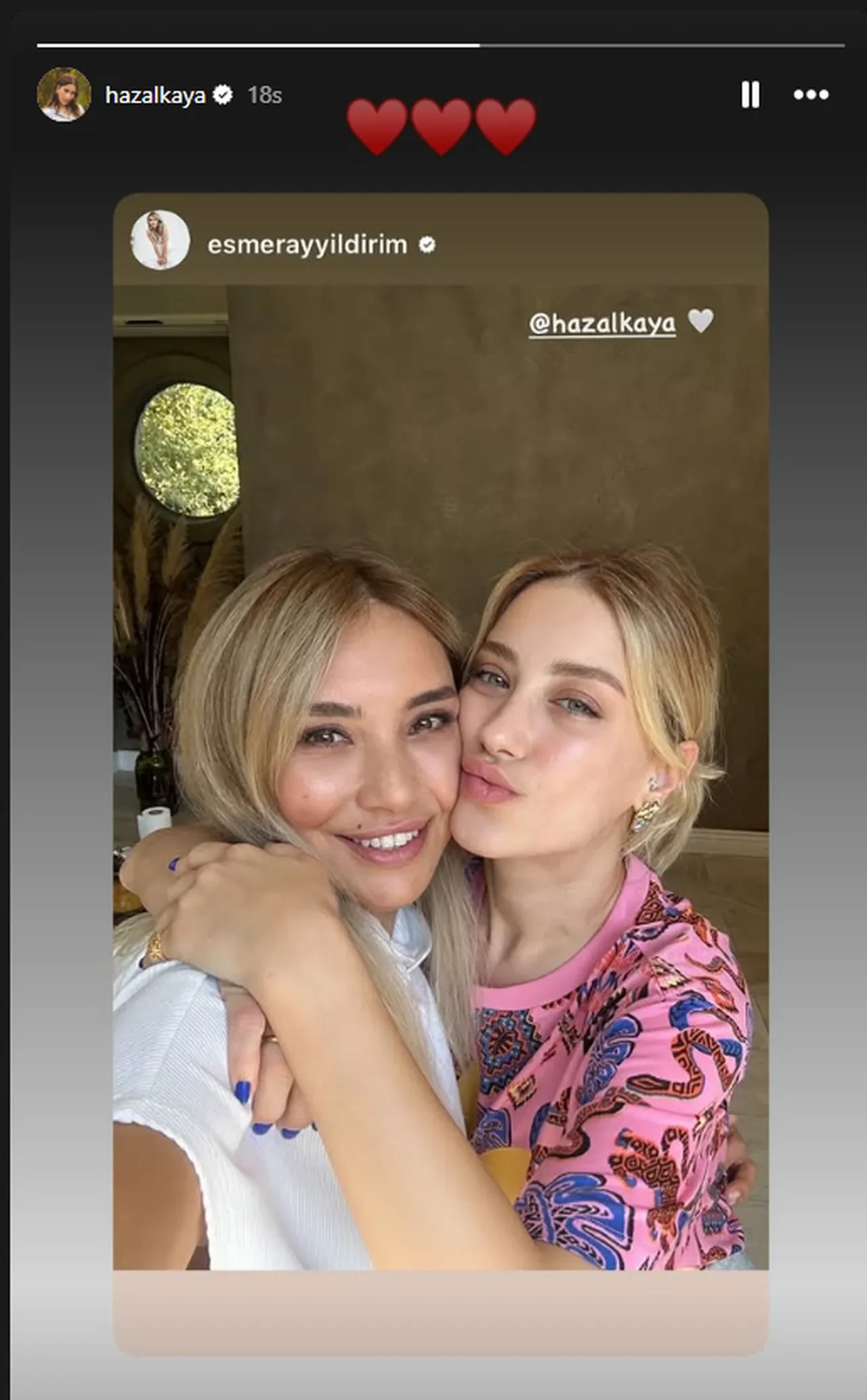 Hazal Kaya'nın yüzündeki değişim dikkat çekti! Son haliyle Büşra Pekin'e benzetildi