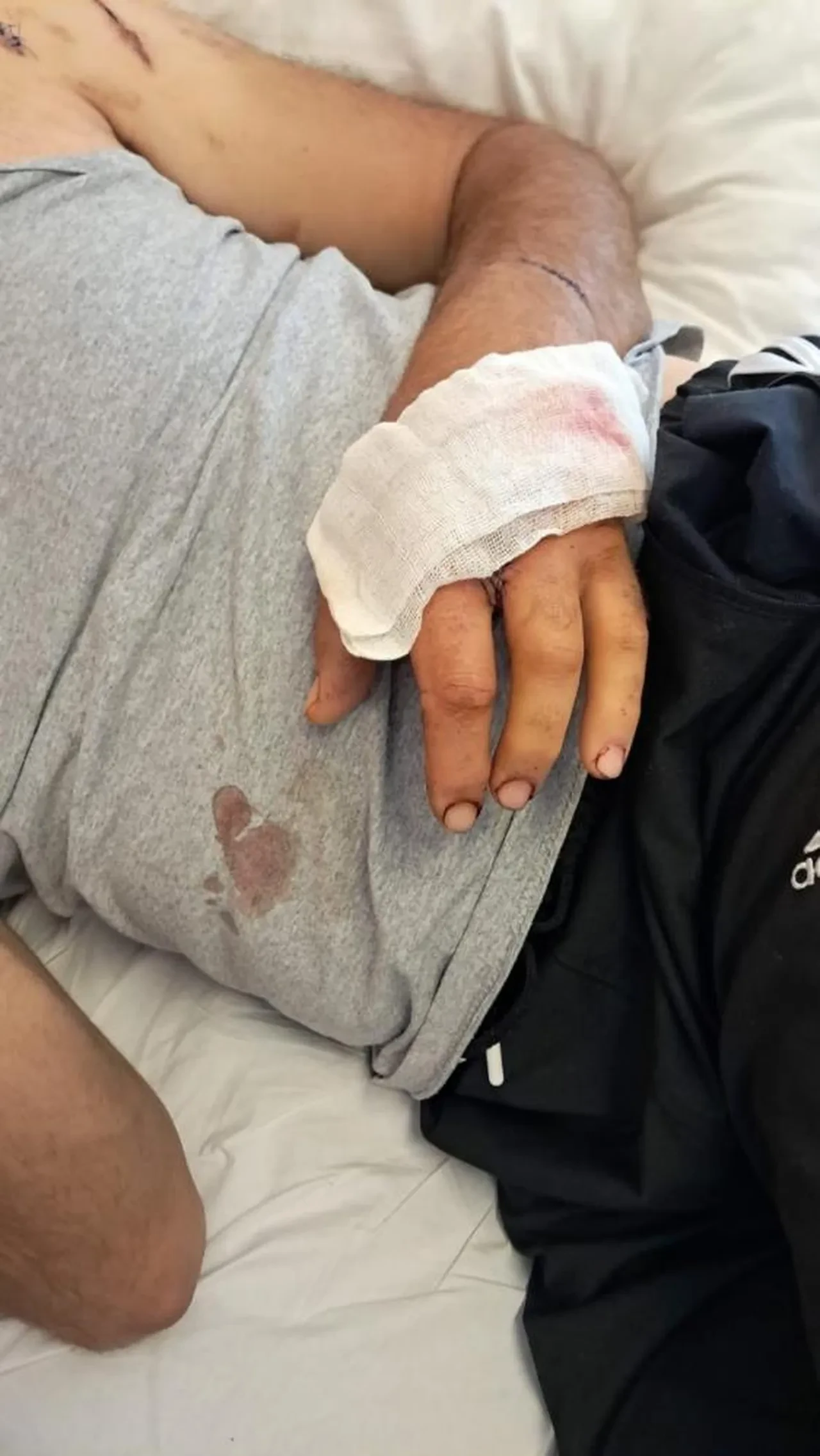 Ayıyla boğuşan çiftçi yaşadığı dehşeti anlattı: "Beni iki ayağının arasına çekti"