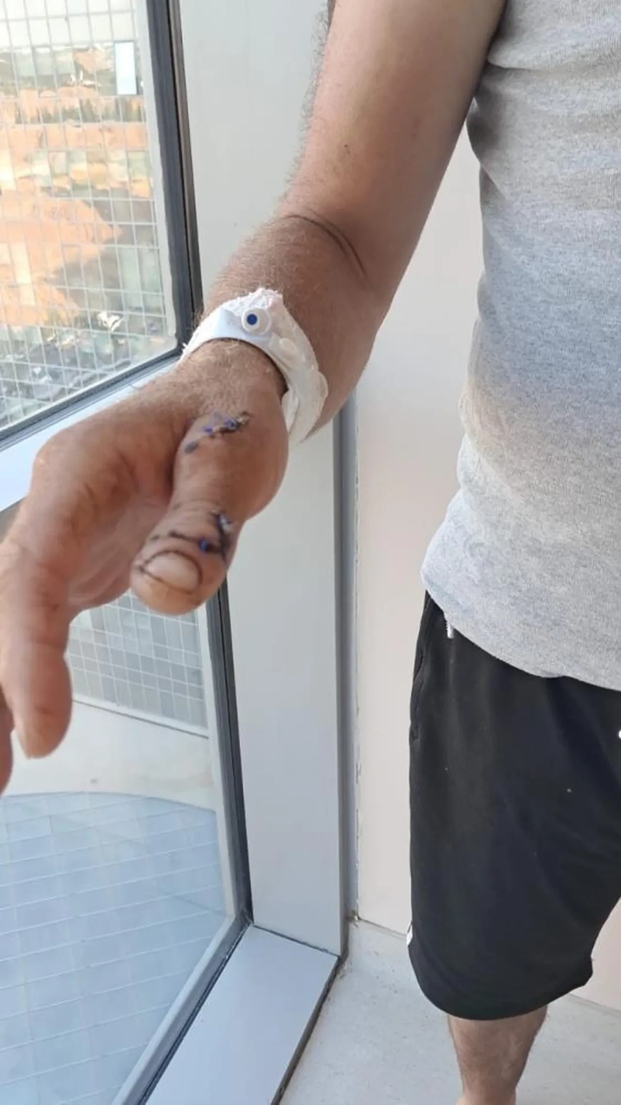 Ayıyla boğuşan çiftçi yaşadığı dehşeti anlattı: "Beni iki ayağının arasına çekti"