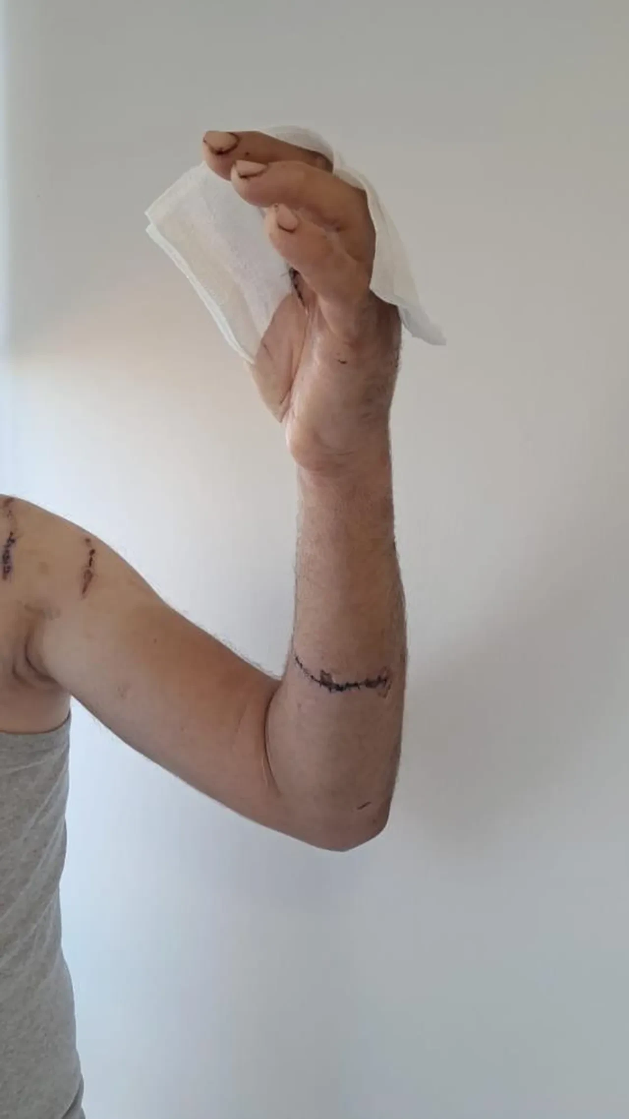 Ayıyla boğuşan çiftçi yaşadığı dehşeti anlattı: "Beni iki ayağının arasına çekti"