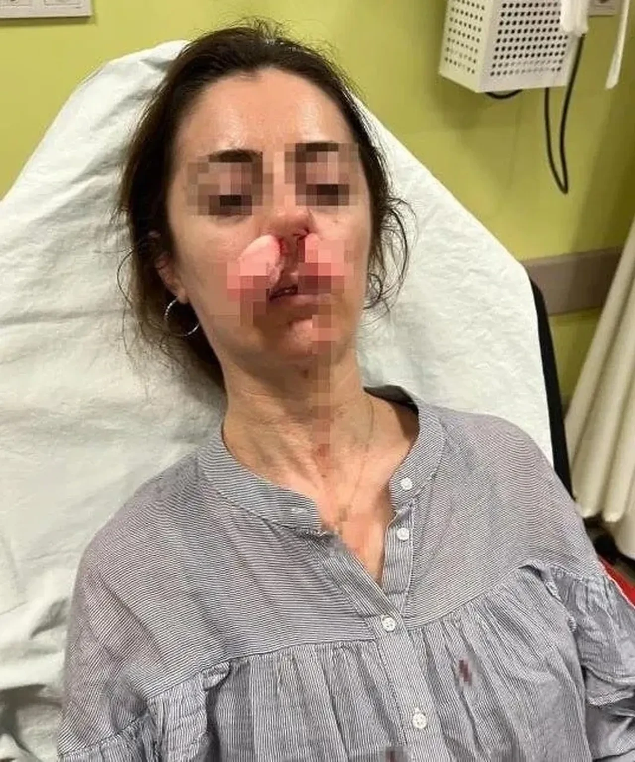 Eşinin sevgilisi sandı, arabanın kapısıyla dövdü! Kapı silah sayıldı