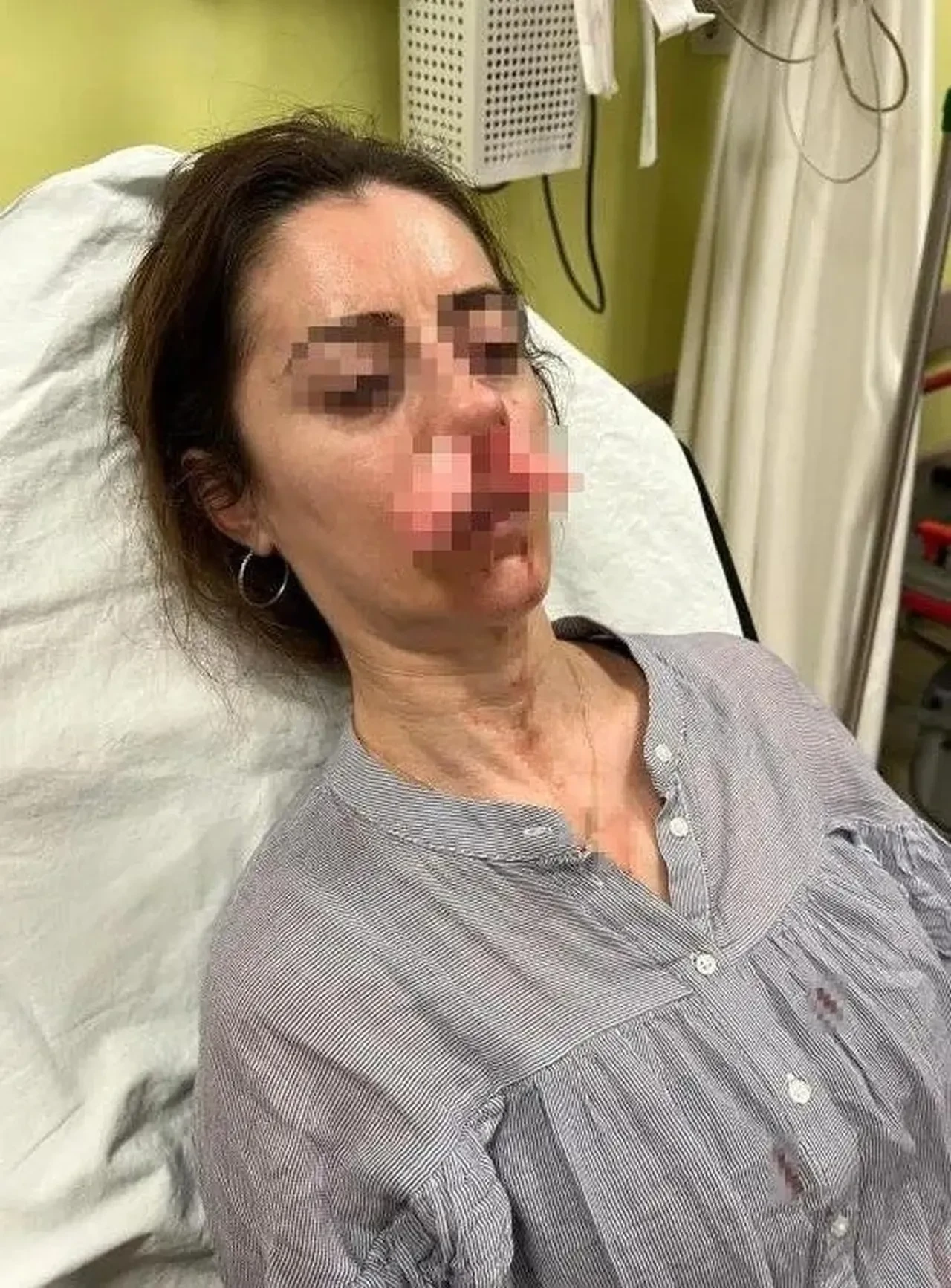 Eşinin sevgilisi sandı, arabanın kapısıyla dövdü! Kapı silah sayıldı