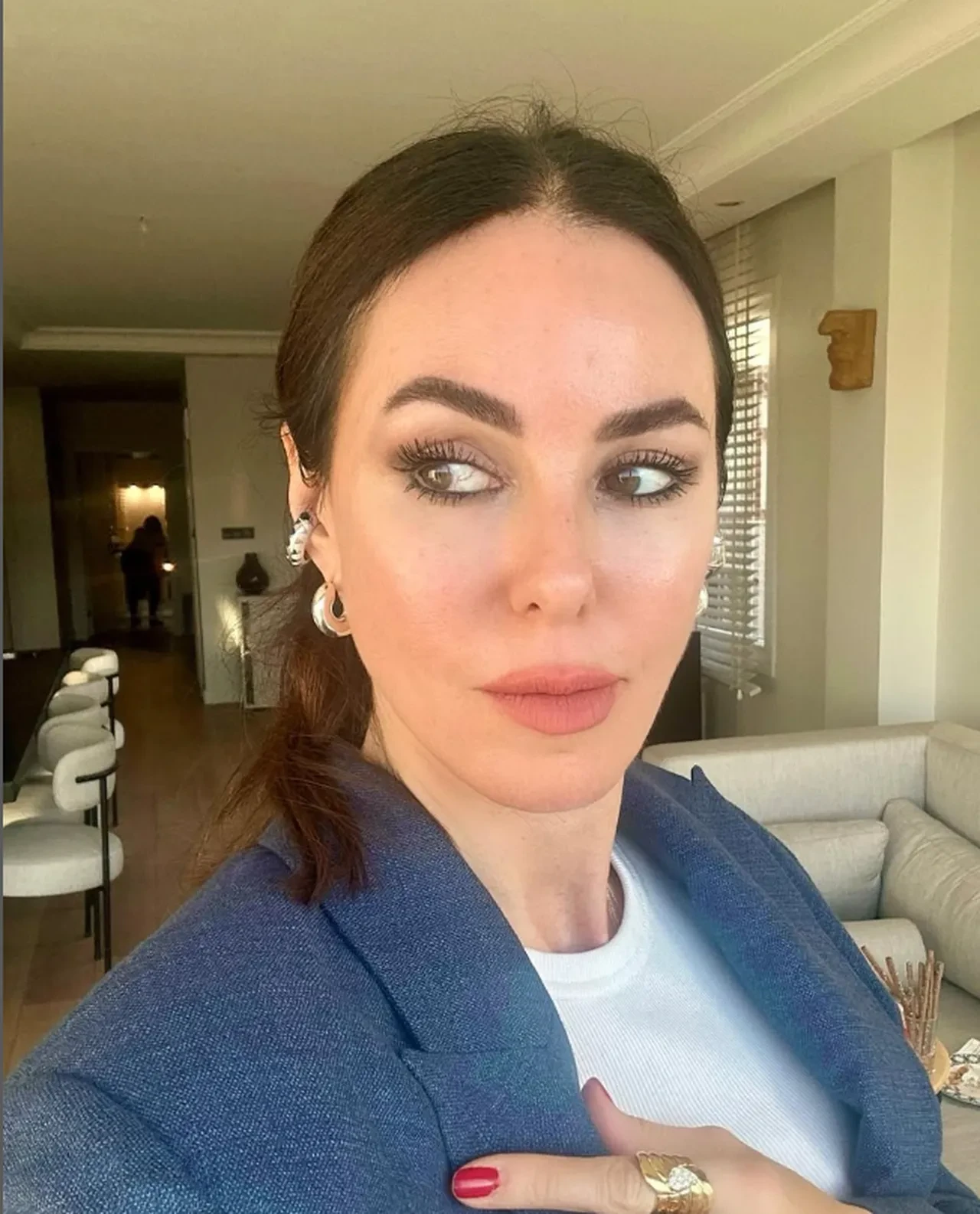 Ece Erken, Defne Samyeli'nin sözlerini yalanladı! Sunucunun yaptırdığı tüm estetikleri sıraladı 