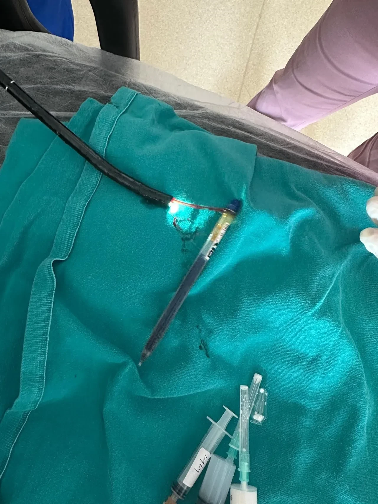 Genç kadının midesinden çıkanlar şoke etti: Bu cisimleri ilk kez gördük