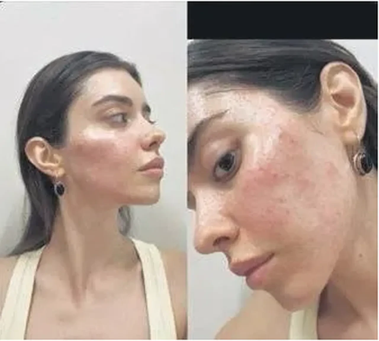 Sosyal medyada görüp aldı, hayatı kabusa döndü! Türkiye güzelinin acı tecrübesi 