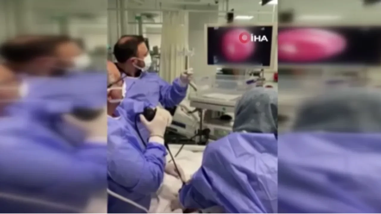 Akciğerine kaçan sarımsak operasyonla çıkarıldı