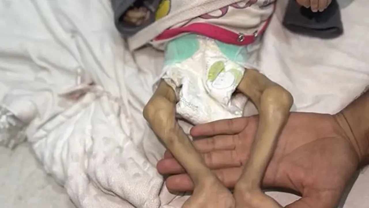 Cumhurbaşkanı Erdoğan BM Genel Kurulu'nda zulmün fotoğrafını gösterip sordu