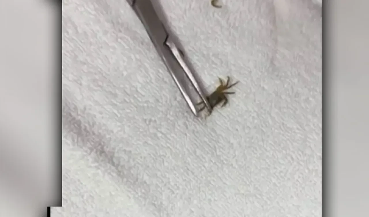 Yeni korku yüklendi: Çocuğun kulağından canlı yengeç çıktı!