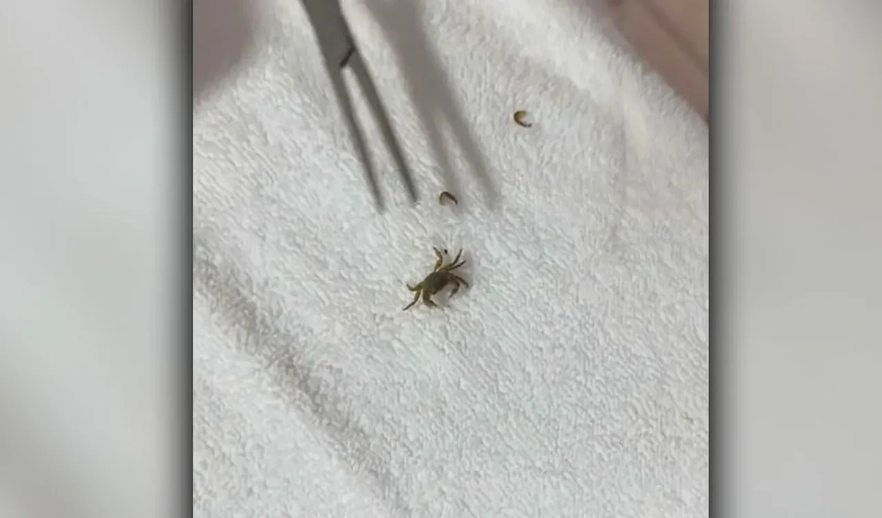 Yeni korku yüklendi: Çocuğun kulağından canlı yengeç çıktı!