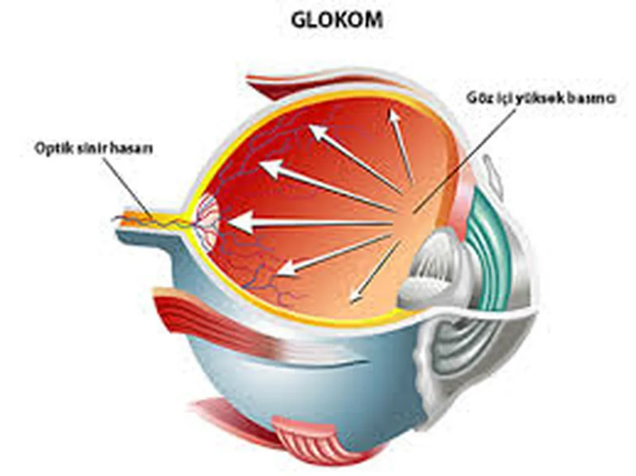 Geri dönüşü olmayan körlük arttı! 2040 yılına kadar 111 milyondan fazla kişiyi etkileyebilir