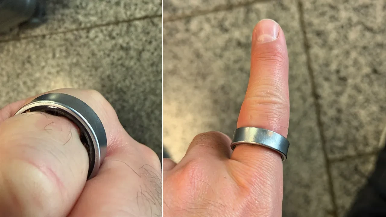 Bataryası şişen akıllı yüzük kullanıcıyı hastanelik etti! Samsung'dan açıklama geldi