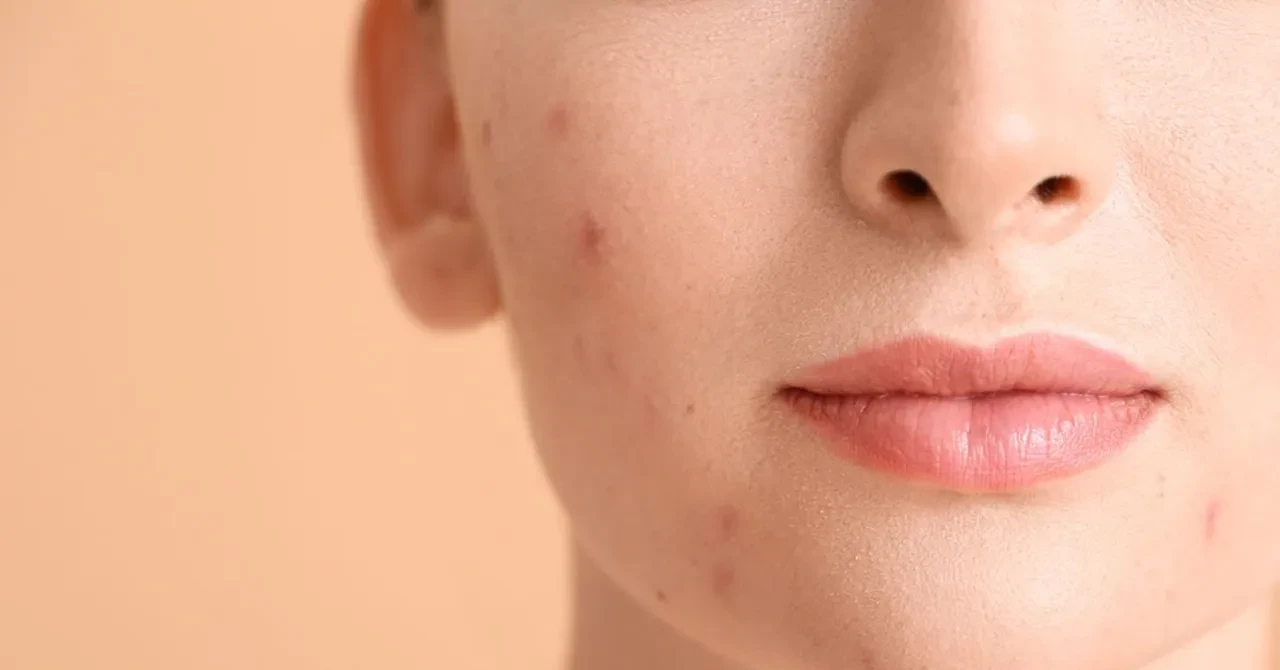 Sivilcelerin sorumlusu bakın neymiş! Yıllarca yanlış bilmişiz