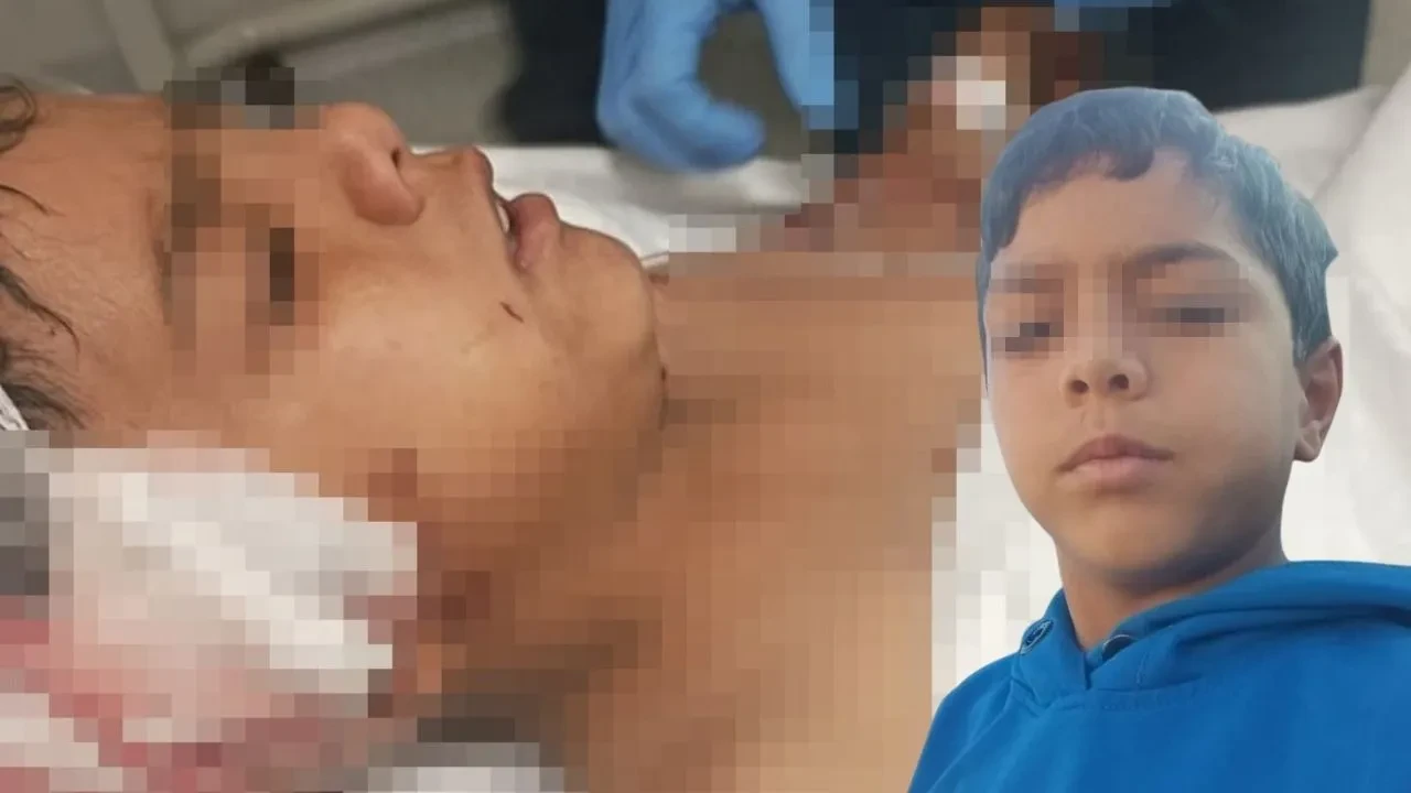 Okul yolunda köpek dehşeti! İlkokul öğrencisi saldırıya uğradı