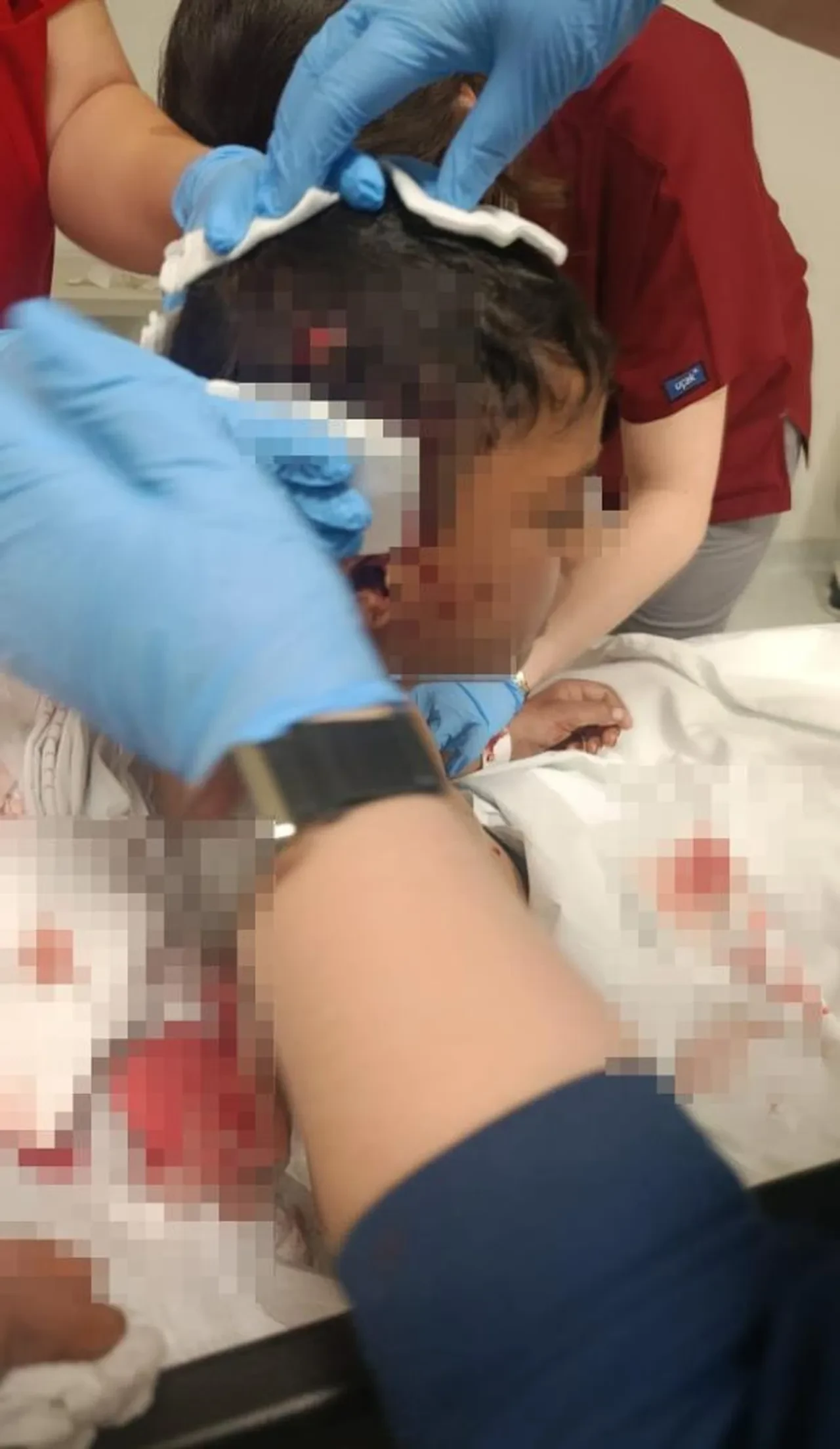 Okul yolunda köpek dehşeti! İlkokul öğrencisi saldırıya uğradı