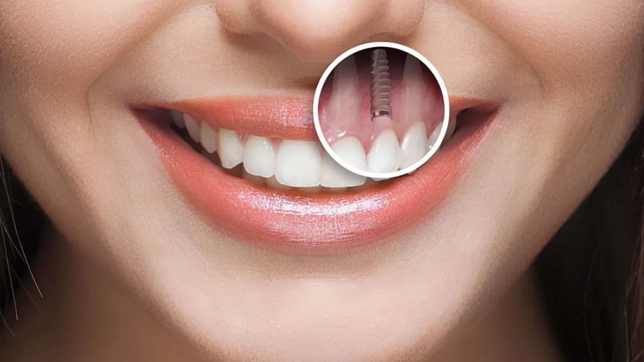 Vücudun kendi dişini yapmasını sağlayan ilaç için geri sayım başladı