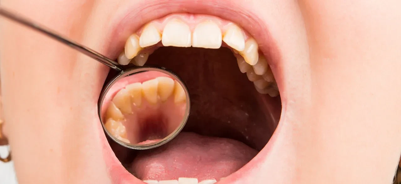 Vücudun kendi dişini yapmasını sağlayan ilaç için geri sayım başladı